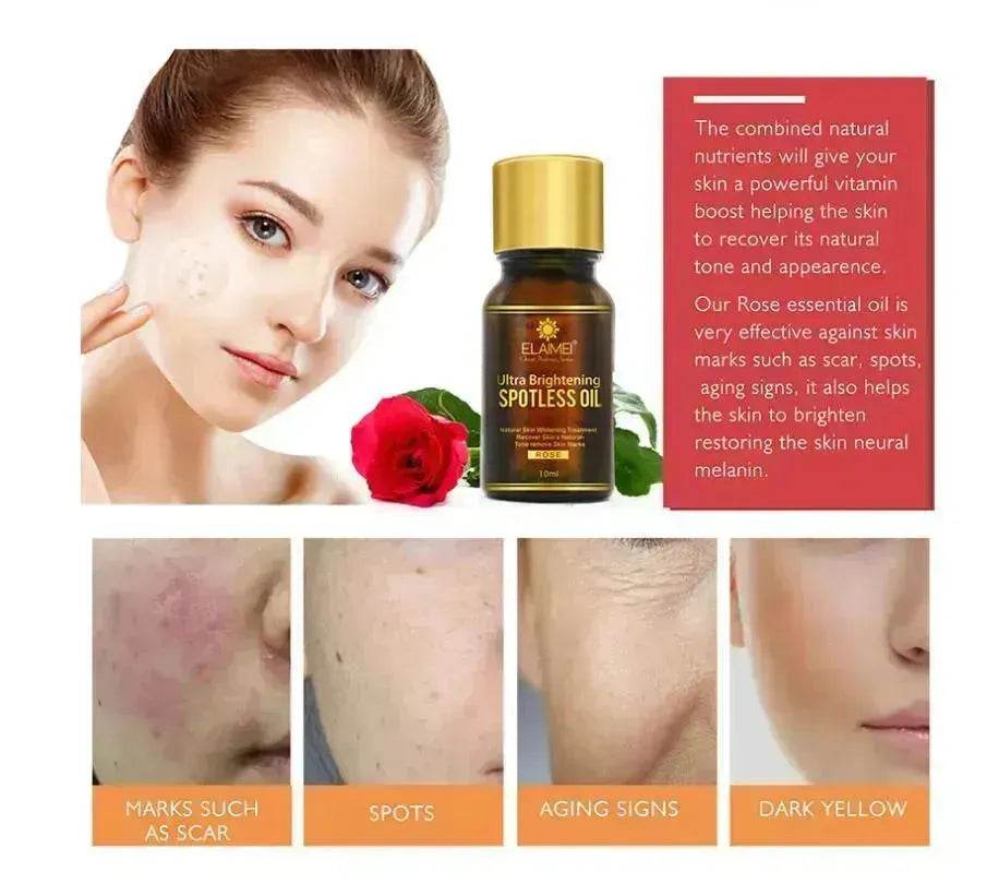 ELAIMEI Huile Ultra Éclaircissante Anti-taches Taches de rousseur et dissolvant de taches brunes