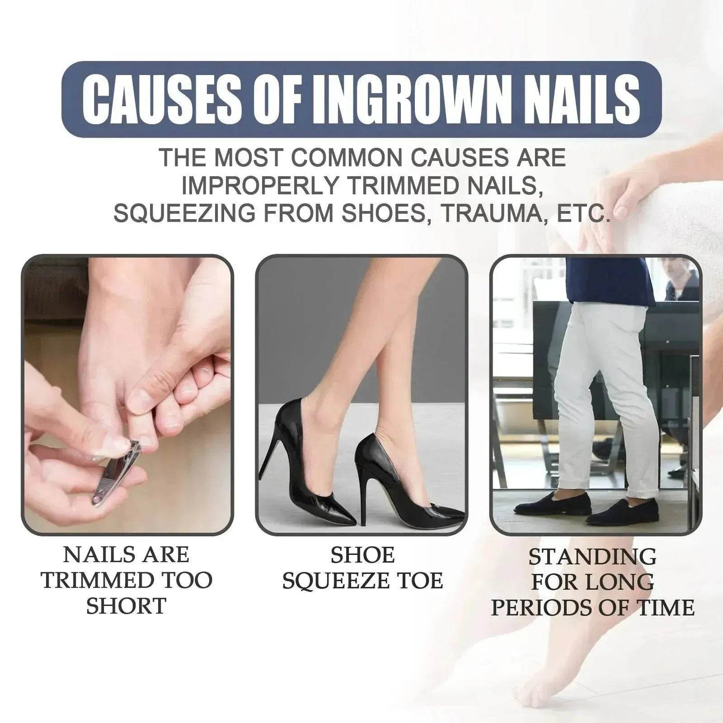 Relieving And Repairing Ingrown Nail Toe Nail Removing Meat Treatment Oil