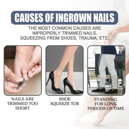 Relieving And Repairing Ingrown Nail Toe Nail Removing Meat Treatment Oil