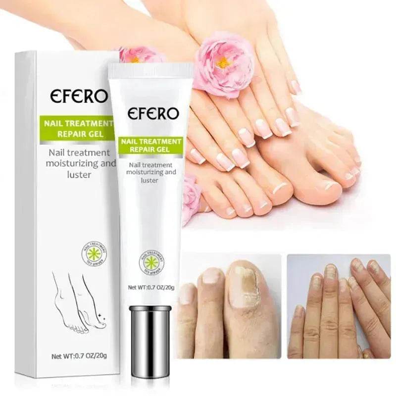 Sérum de Traitement des Ongles, Gel Éliminateur de Champignons des Ongles, Crème Réparatrice des Ongles Anti-Infection Onychomycose, Soin des Pieds