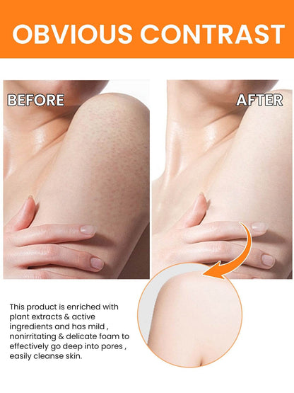 Turmeric Oil 30ml - For The Face
