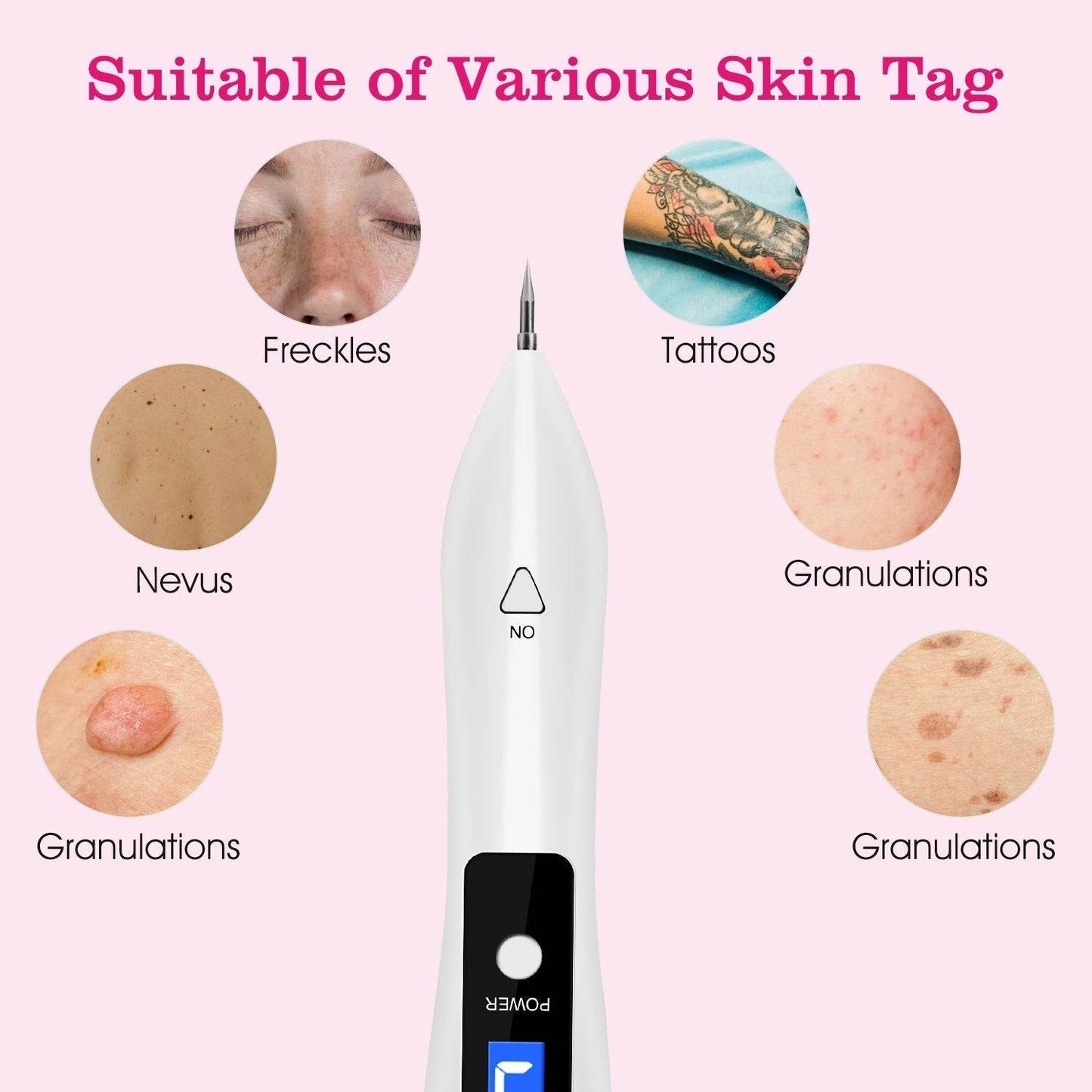 Skin Tag Repair Kit Portable Beauty Equipment Multi-Level With Home Usage USB Charging LCD Level Adjustable 6 Replaceable Needles