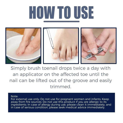 Relieving And Repairing Ingrown Nail Toe Nail Removing Meat Treatment Oil