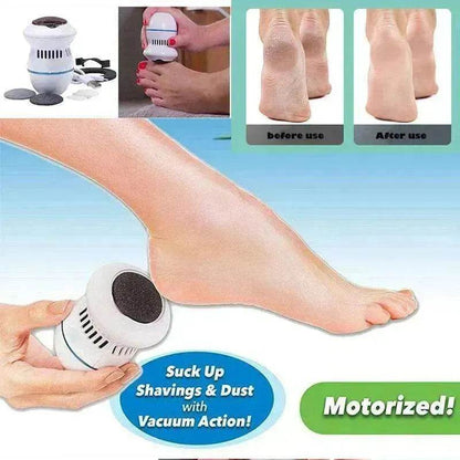 Exfoliate Dead Skin Callus Remover Heel Electric Vacuum Foot Grinder File Machine