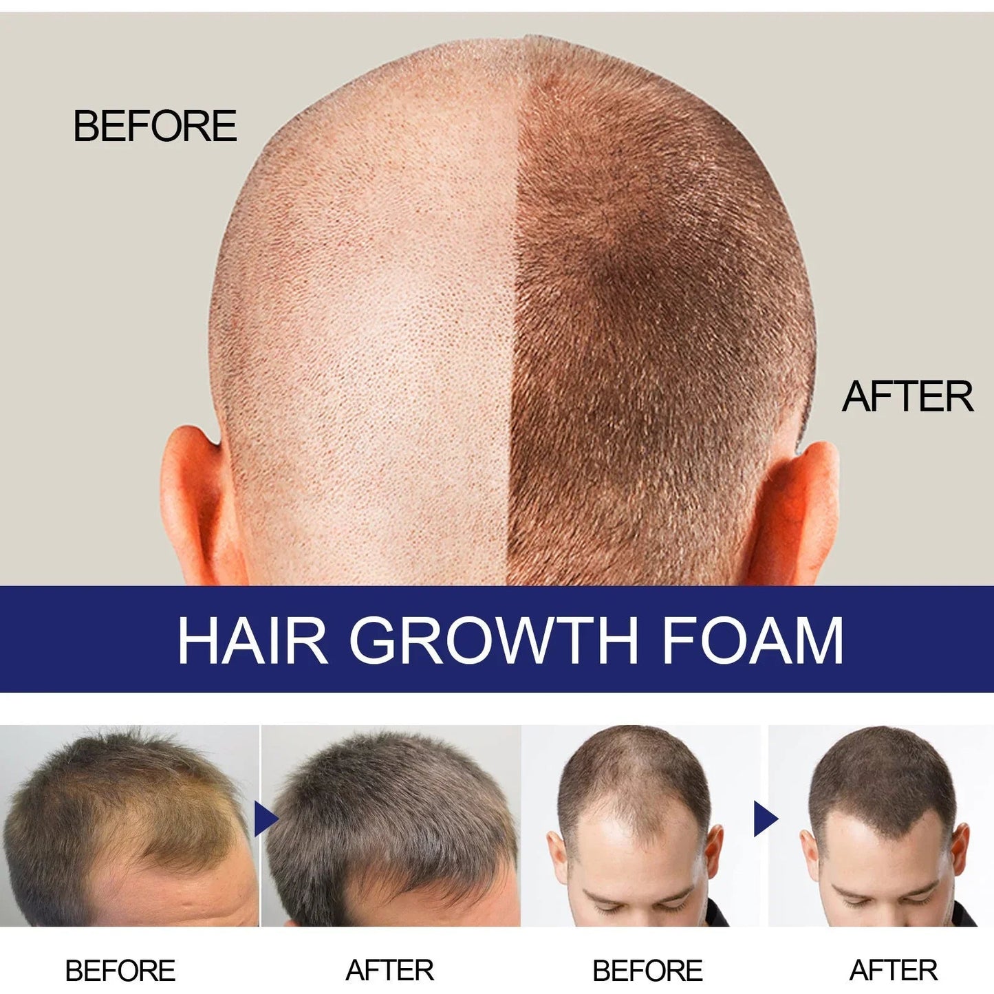 N Mousse Capillaire Épaisse Homme Soin Réparateur Profond