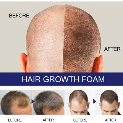 N Mousse Capillaire Épaisse Homme Soin Réparateur Profond