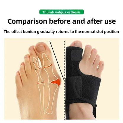 Correcteur d'hallux Valgus, orthèses, séparateur d'orteils, ajusteur d'os des pieds, lisseur de pouce, soulagement de la douleur, pédicure, outil de soins des pieds