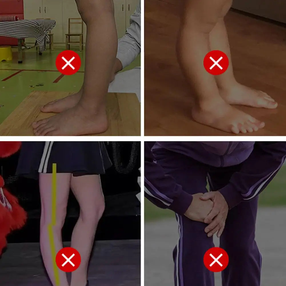 Knee Hyperextension Orthosis for Hemiplegia, Knee Joint Fixation Brace, Leg Recovery Stabilizers with Arch Support