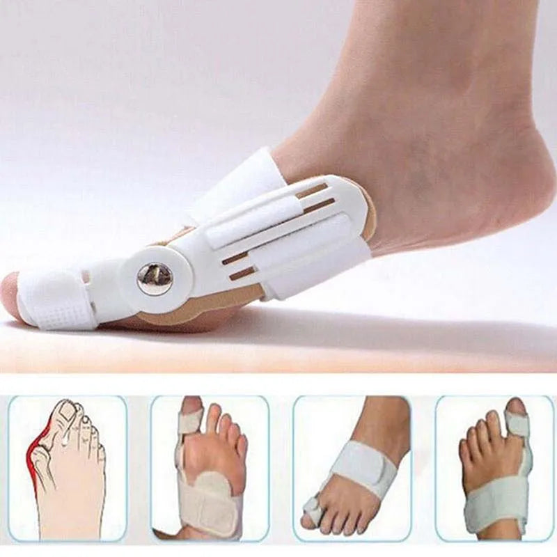 Correcteur orthopédique, attelle d'oignon, redresseur de gros orteils, soulagement de la douleur au pied, Correction d'hallux Valgus, pédicure, soins des pieds