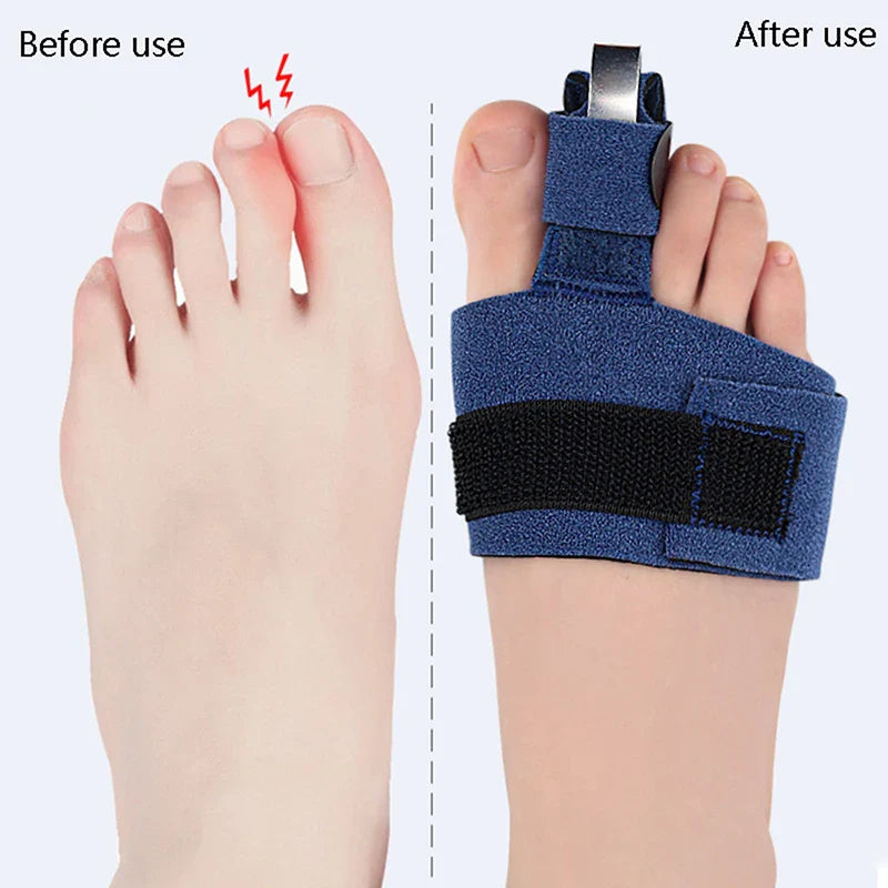 Fixateur de Fracture pour Pieds Sophia, Ajusteur de Pouce, Chaussettes de Pédicure Douces, Lisseur d'Oignon, 1 Pièce