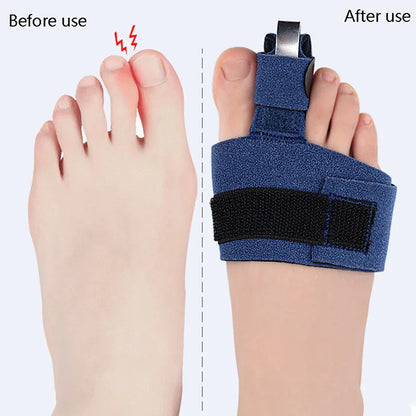 Fixateur de Fracture pour Pieds Sophia, Ajusteur de Pouce, Chaussettes de Pédicure Douces, Lisseur d'Oignon, 1 Pièce