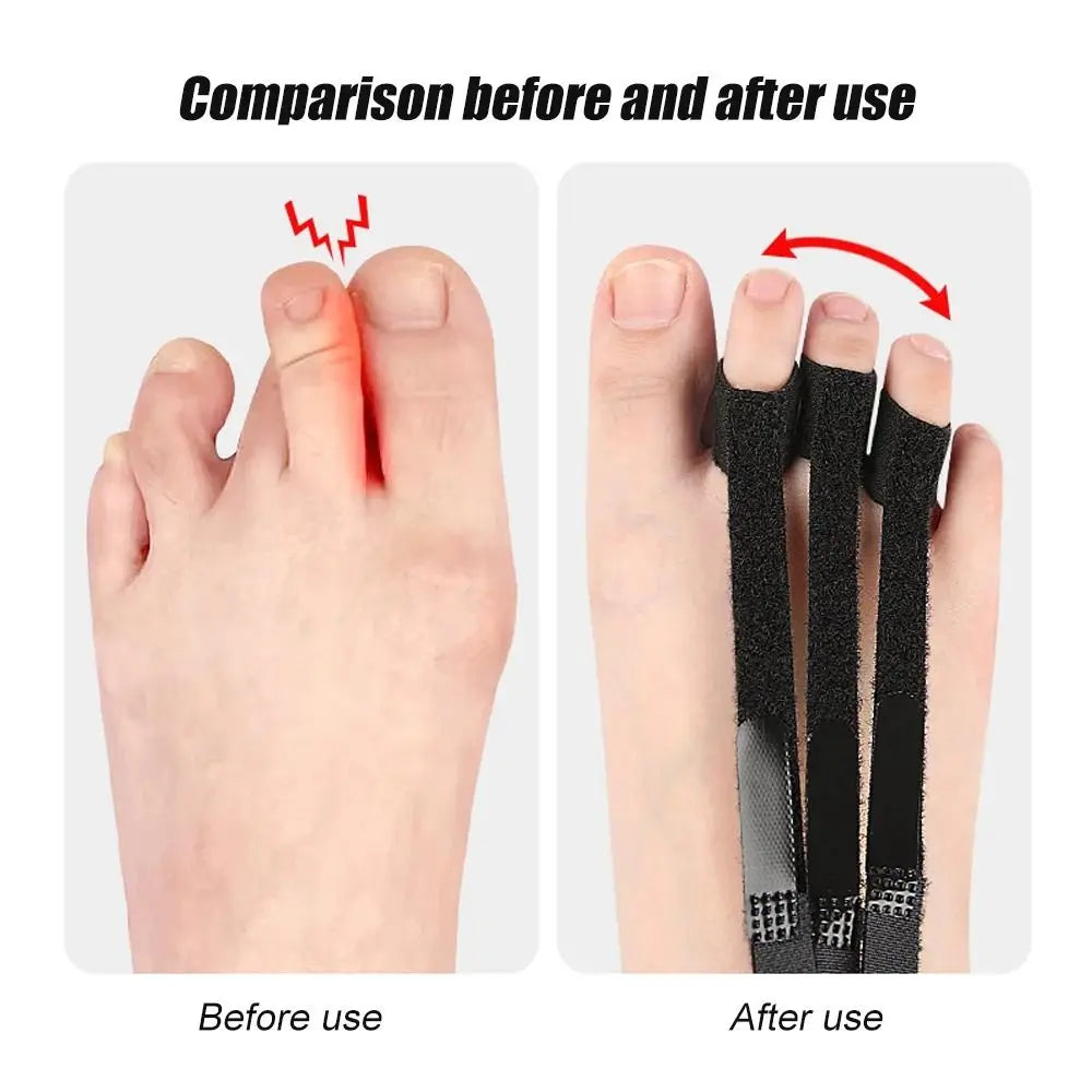 Correcteur d'orteils réglable, orthèses fixées et réglables, correcteur de Valgus d'orteil bouclé, attelle d'orteil respirante avec boucle en métal