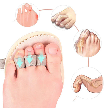 1PCS Unisex Hammer Toe Cushions Protector Separator Support Pads Straightener Bunion Guard Temporary Corrector 4Styles