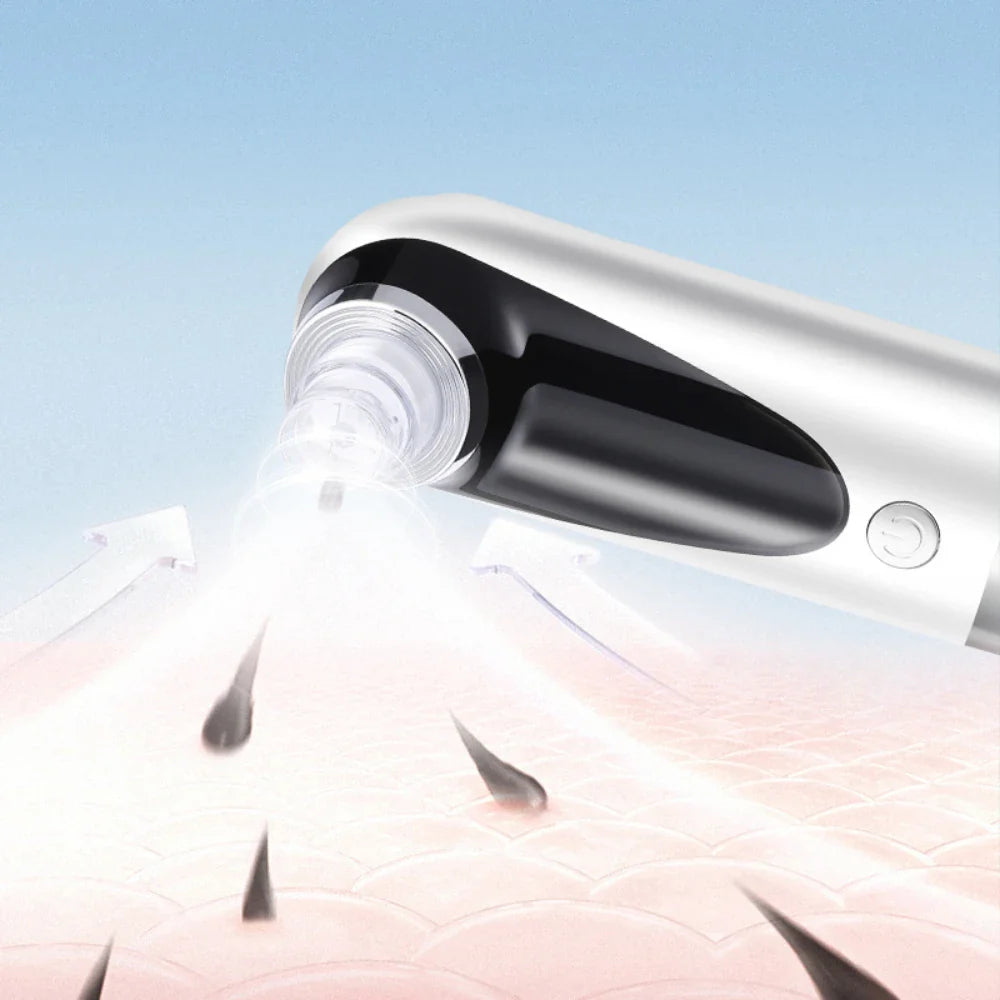 Dissolvant de points noirs électrique, aspirateur de pores, Micro petites bulles, Cycle d'eau Rechargeable, élimination des points noirs