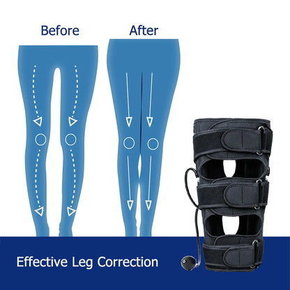 Correcteur orthopédique de jambes O X pour adultes, Correction de redressage des jambes, Traction physique, redressage des jambes, attelle de beauté en forme de jambes