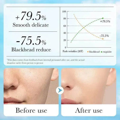 Aloe Pore Clear Solid Mask Cleaning