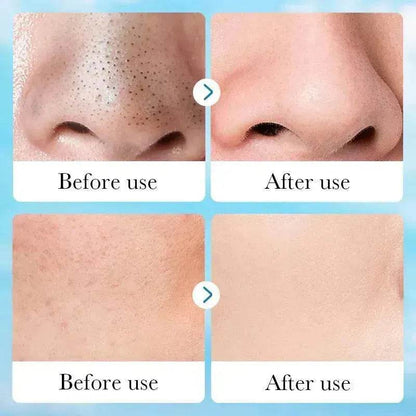 Aloe Pore Clear Solid Mask Cleaning
