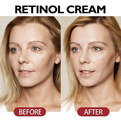 Anti-Aging Nourishing And Firming Skin Anti-wrinkle Face Cream