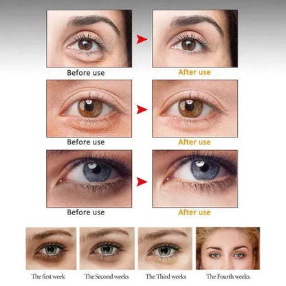 ARTISCARE Anti Wrinkle Eye cream Dark Circle Remover