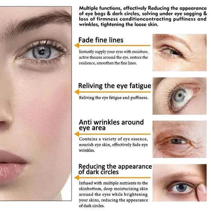 ARTISCARE Anti Wrinkle Eye cream Dark Circle Remover