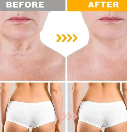 Crazylife Bee Venom Dual-purpose Body Face Repair Cream