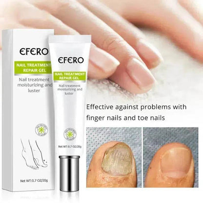 Sérum de Traitement des Ongles, Gel Éliminateur de Champignons des Ongles, Crème Réparatrice des Ongles Anti-Infection Onychomycose, Soin des Pieds