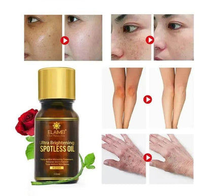 ELAIMEI Huile Ultra Éclaircissante Anti-taches Taches de rousseur et dissolvant de taches brunes