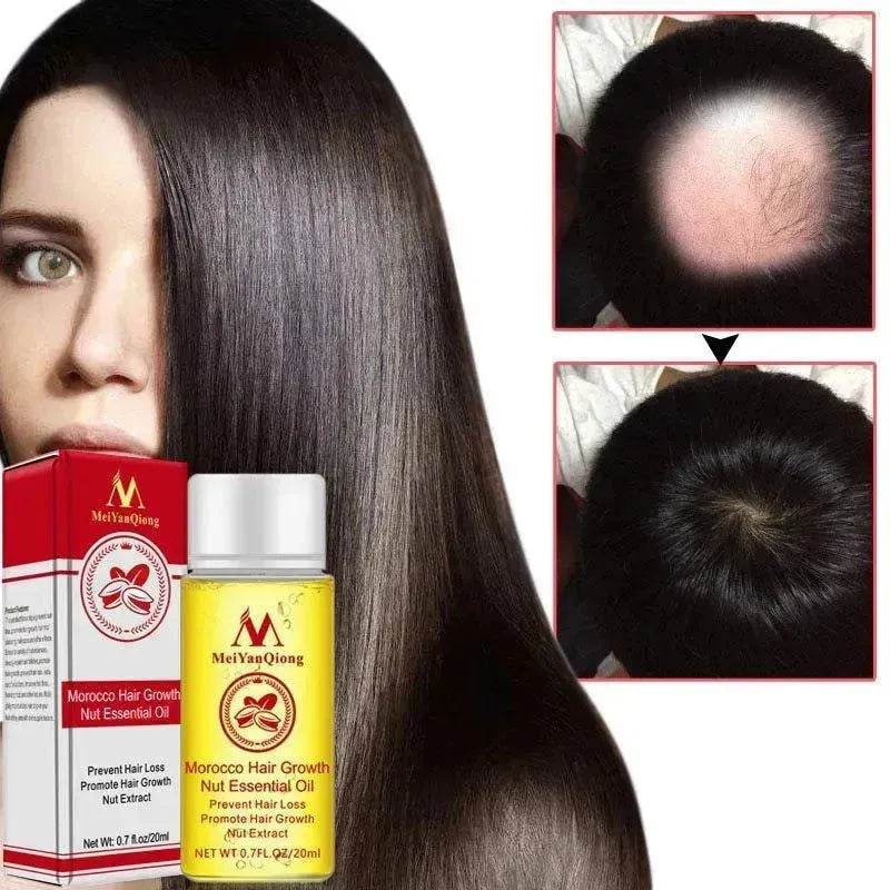 Hair Care Essential Oil , Promote Hair Growth, Shinny smooth texture, Moisturizes hair