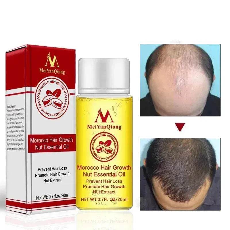 Hair Care Essential Oil , Promote Hair Growth, Shinny smooth texture, Moisturizes hair