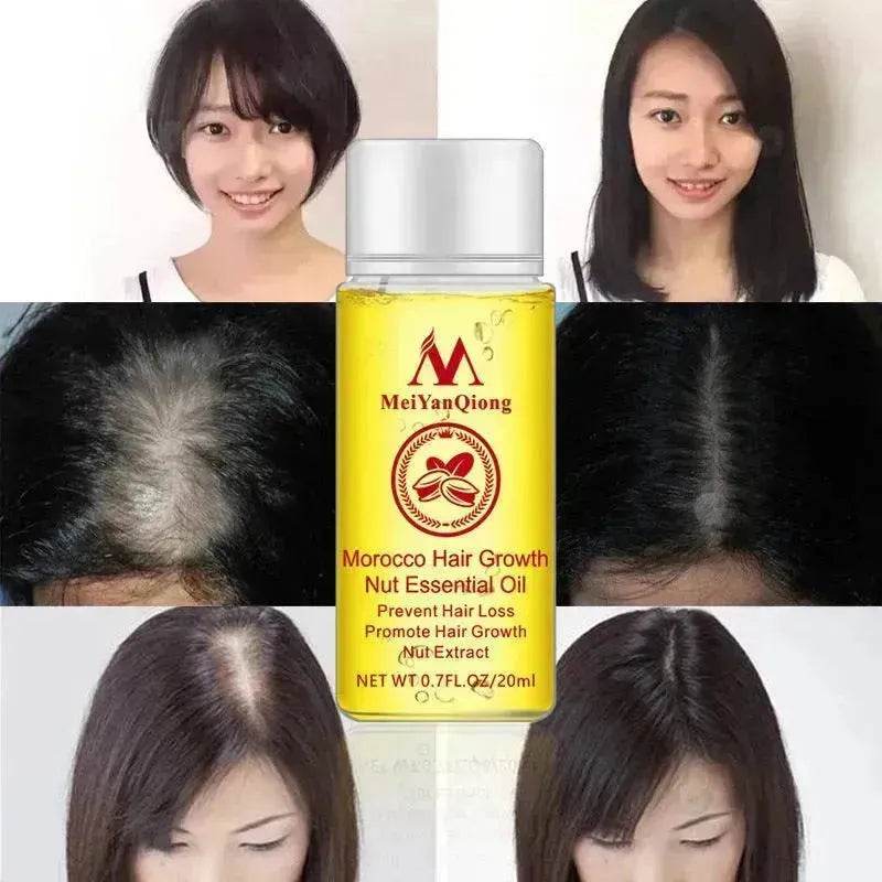 Hair Care Essential Oil , Promote Hair Growth, Shinny smooth texture, Moisturizes hair
