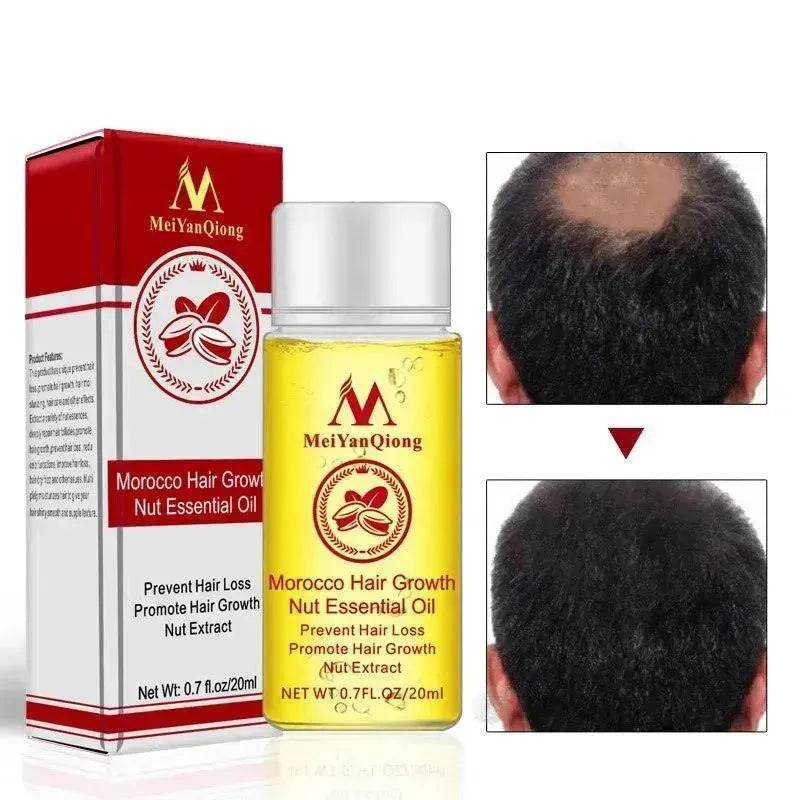 Hair Care Essential Oil , Promote Hair Growth, Shinny smooth texture, Moisturizes hair